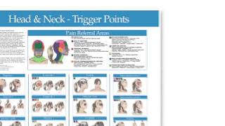 Highlights   Trigger Point Wall Chart   Head and Neck Chart