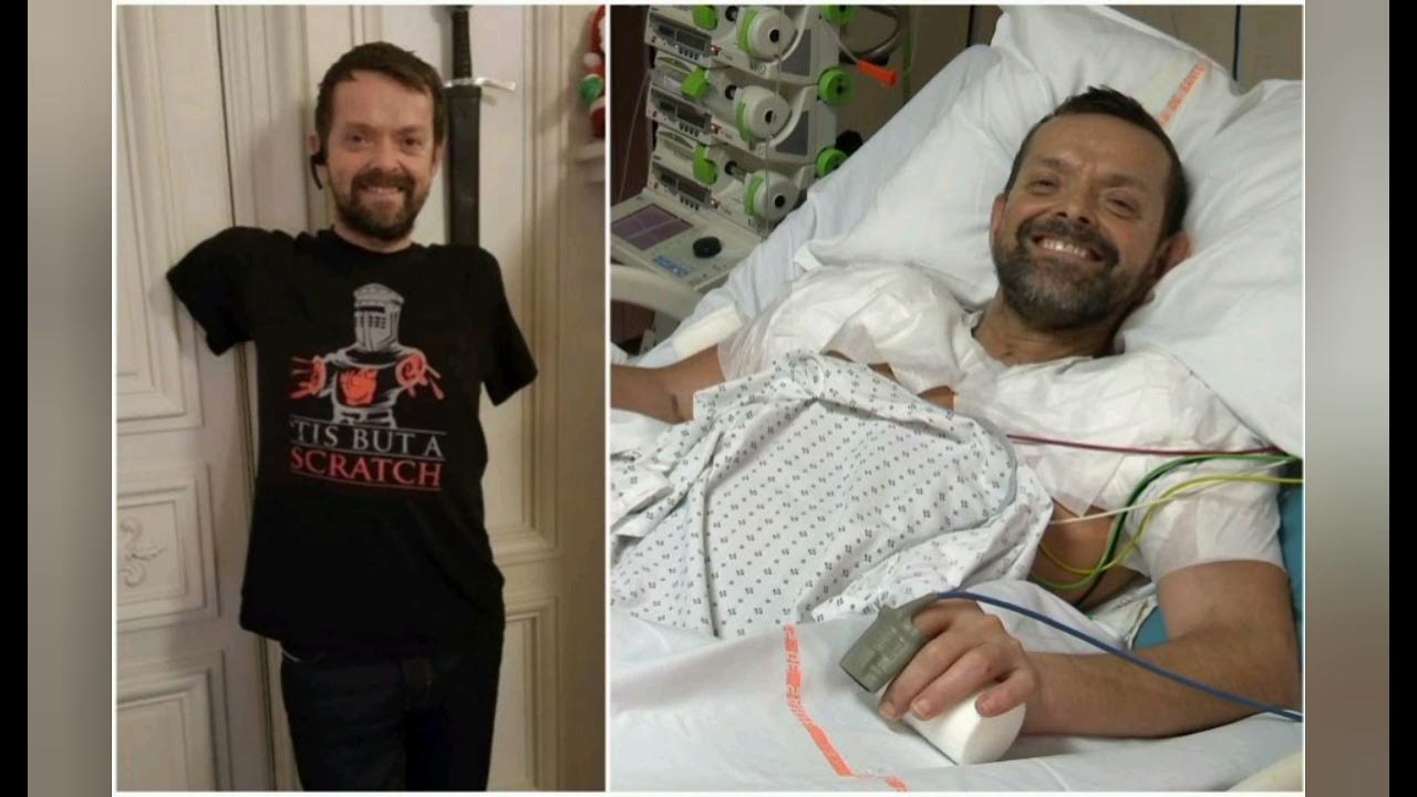 Трансплантация лица: перспективы Портал