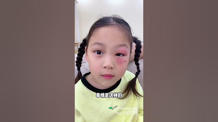 聽說父愛如山，那就讓蚊子咬爸爸吧！ #萌娃#親子#親子日常#搞笑#爸爸帶娃#父母搞笑 #funny