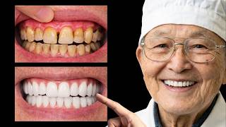 Worlds Oldest Dentist Just Eat These And Live To 100