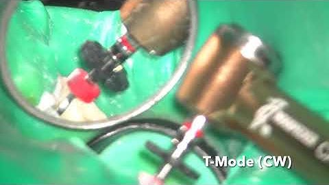 Root Canal Preparation of Ledge Section using Ai-Motor (T-Mode)
