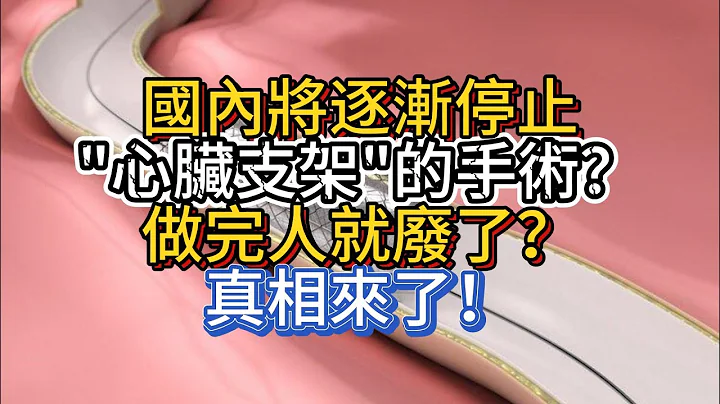 國內將逐漸停止「心臟支架」的手術？做完人就廢了？真相來了！ - 天天要聞