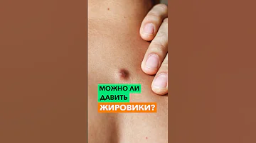 Можно ли давить жировики?