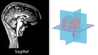 MRI / 3D Brain Anatomy: Internal Capsule, Thalamus & Brainstem