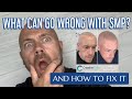 What can go wrong with SMP & How to fix it | Creative Scalps | Scalp MicroPigmentation