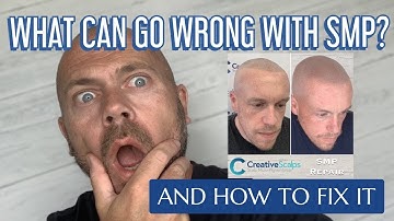 What can go wrong with SMP & How to fix it | Creative Scalps | Scalp MicroPigmentation