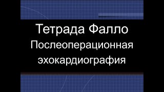 Тетрада Фалло, послеоперационная ЭхоКГ.