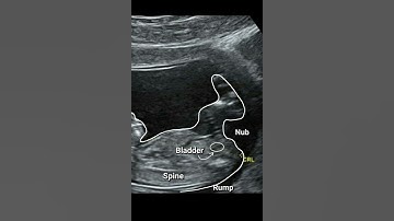 Nub Theory Explained: Gender Reveal app name nubx