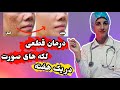 درمان قطعی لک صورت در یک هفته بهترین ماسک برای لک های قهوه ای صورت درمان لک صورت خانگی