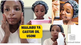 Ondoa Chunusi Na Mafuta Usoni Kwa Castor Oil Castor Oil For Acnes Removal