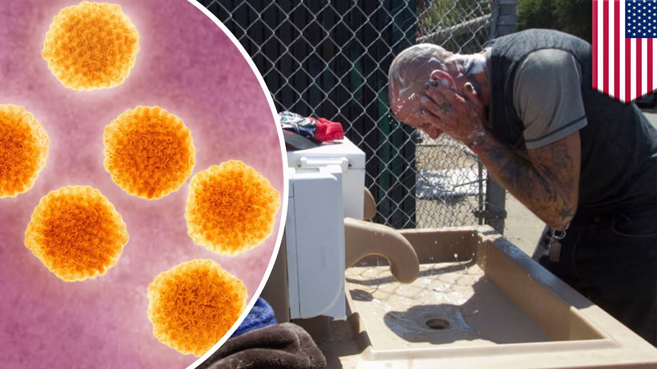 California combats deadly hepatitis A outbreak