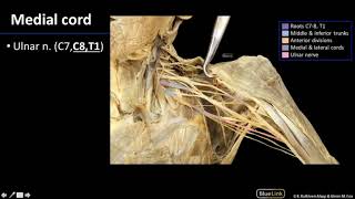 Brachial Plexus: Shoulder \& Brachial Plexus - Dissection Supplement
