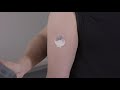 Medtronic™ Guardian™ Sensor 3 – Inserting Sensor into Upper Arm
