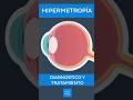 Hipermetropía: Diagnóstico y tratamiento | Kenhub #hipermetropía