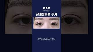 무쌍에서 세련된 쌍꺼풀 라인을💫