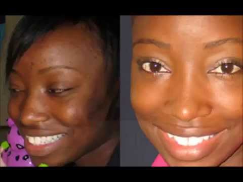 How To Brighten Skin - Find Out The Best Method - YouTube