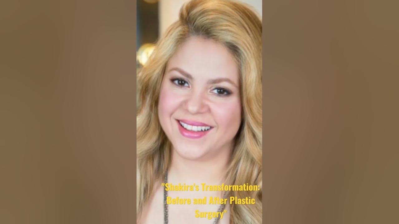 Shakira's Transformation: Before and After Plastic Surgery - YouTube