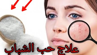 شاهد وصفاتنا الطبيعيه لعلاج حب الشباب