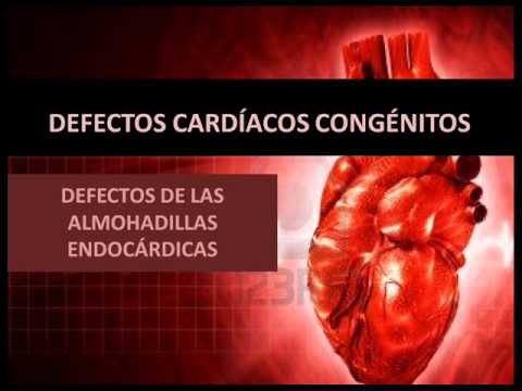 Video: ¿Cómo tratar el defecto del cojín endocárdico?