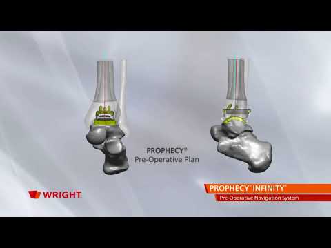 Wright TAR patient video PROPHECY INFINITY