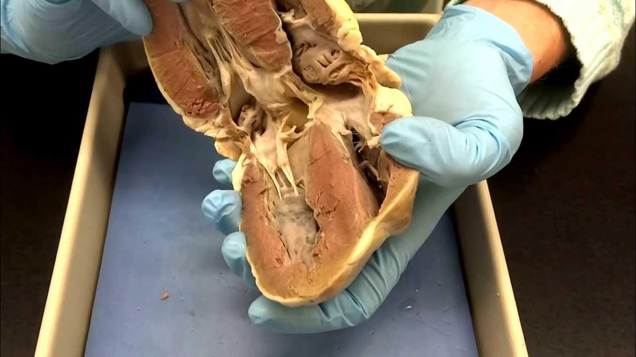 Cardiovascular system Part 3b Heart dissection (valves and vessels
