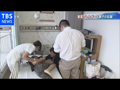 重度アレルギーと親子の記録【報道特集】