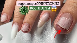 🦠 коронавирус УНИЧТОЖИЛ все ногти 😧🤭