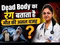 Cyanosis vs Postmortem: मरने के बाद शरीर का रंग नीला क्यों हो जाता है? जानिए! | Felix Hospital