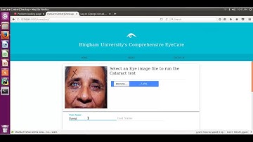 Demo of an Automated Cataract detection System using Artificial Neural Networks