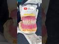 Can You Find My Name in This Denture? 👀#satisfying#dentist#dental#cesar#parati#shorts#fyp#viral#yt