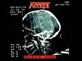 Accept - 1994 - Death Row © [Full Album] © Vinyl Rip [2×LP]