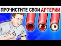 Прочистите Сосуды, Артерии | Доктор Вивек