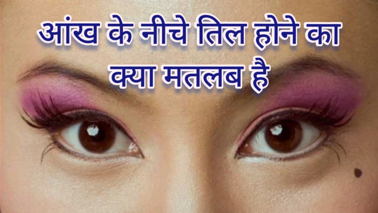 Bayi Aankh Ke Niche Til Ka MATLAB Mole bayi-aankh-ke-niche-til-ka-matlab-mole