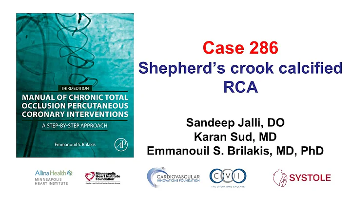 Case 286: Manual of CTO PCI - Shepherd’s crook calcified RCA