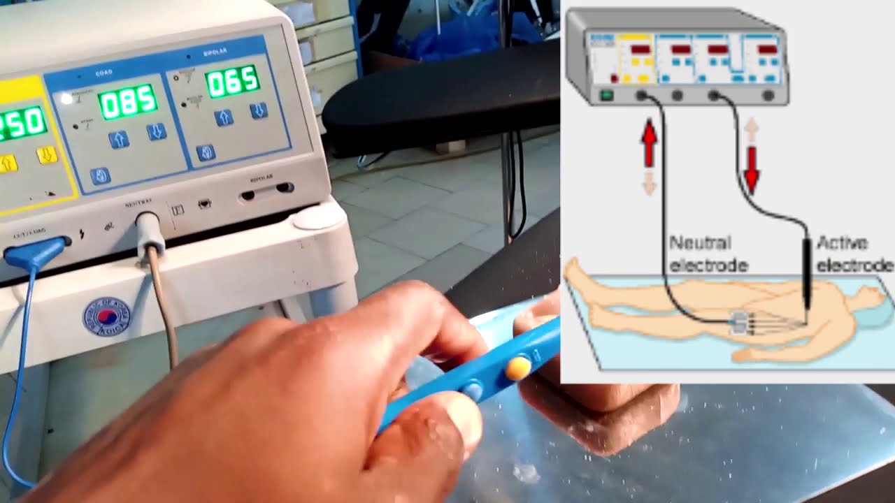 GÉNÉRATEUR  DE BISTOURIS ÉLECTRIQUE: FONCTIONNEMENT , UTILISATION ET MAINTENANCE