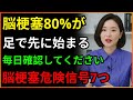 脳梗塞の前兆症状7つ!70代脳梗塞死亡率1位!| 医師が語らない脳の秘密 | 血管回復 | シニア健康