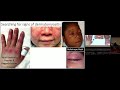 Middle of video