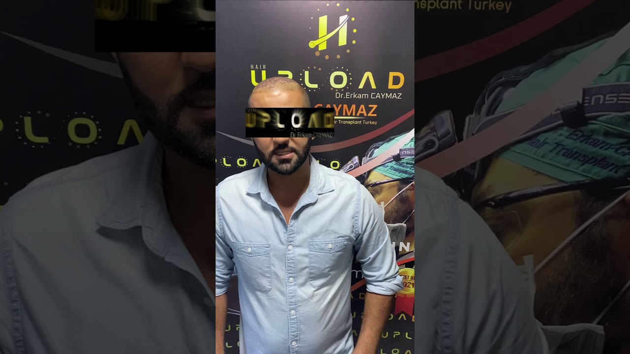 Mr Private from USA - 5000 Graft - Hair Upload Clinic - Hair Transplant in Istanbul Review