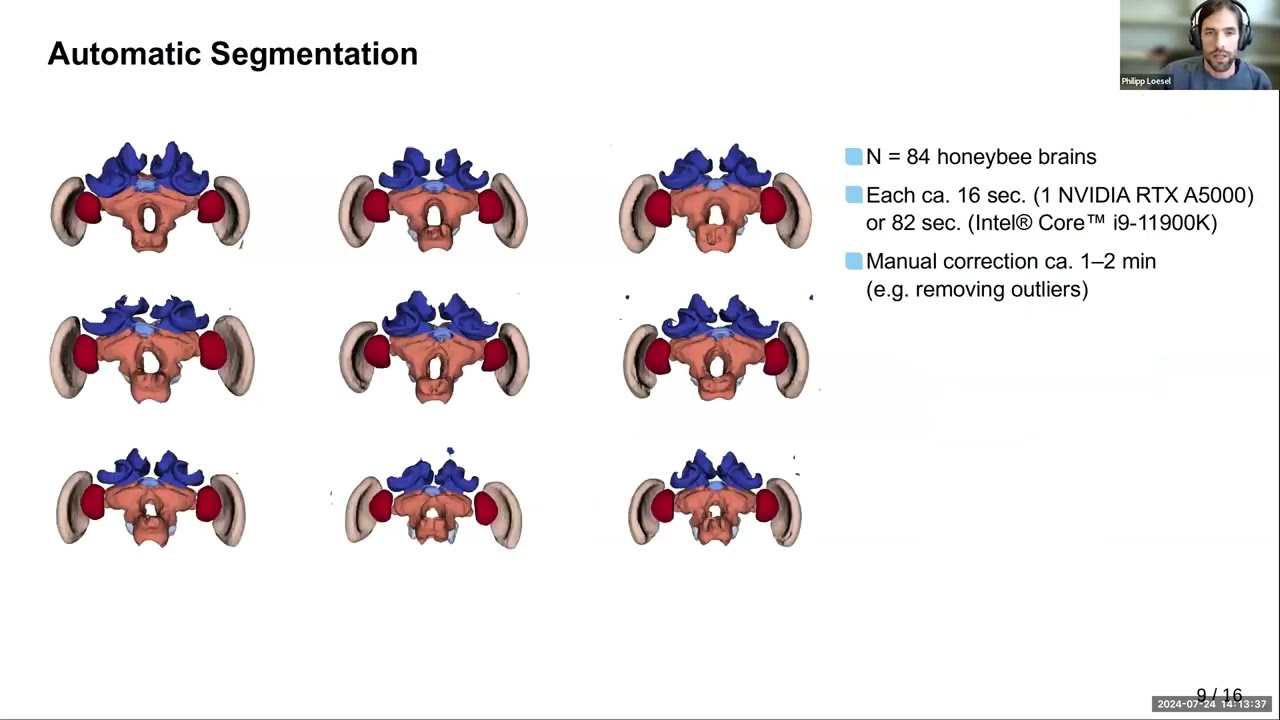 VIA Webinar: (Semi-) automated segmentation of biological images