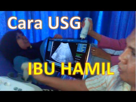 Cara Dokter Melakukan USG Ibu Hamil