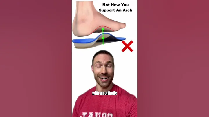 ¿El soporte de arco es una mentira?