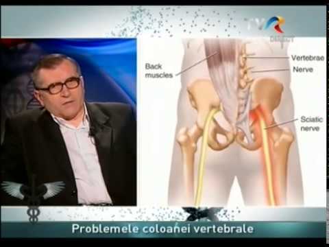 durerile lombare diagnostic si tratament