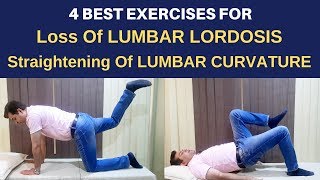 Lumbar lordosis, Lumbar spine curvature, Loss of Lumbar Lordosis Exercises, Flat Back Exercises