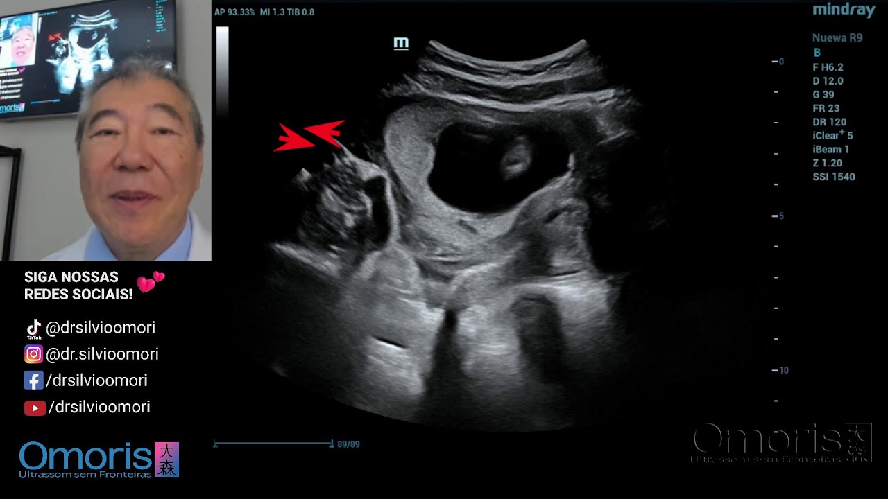 CHÁ REVELAÇÃO - 16s