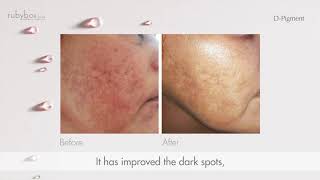 avene d pigment dark spot corrector