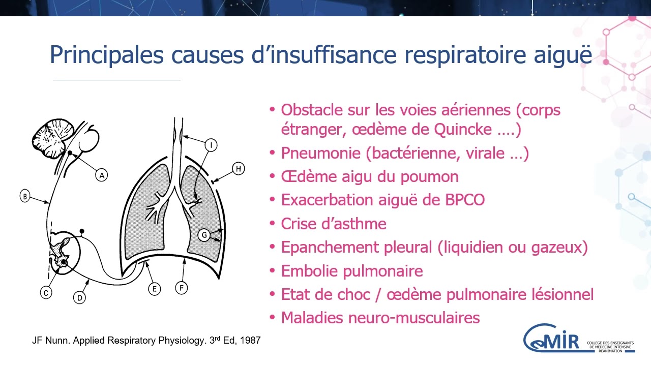 4 21 1 dyspnée, détresse et insuffisance respiratoire aiguë