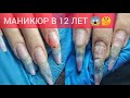 УБИЛА НОГТИ В 12 ЛЕТ 🤕😱 СЛОЖНАЯ КОРРЕКЦИЯ👷🤯