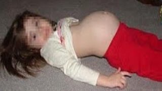 طفلة عمرها 11 سنة حامل من اخوها الصغير !! طفلة عمرها 11 سنة حامل من اخوها الصغير !!