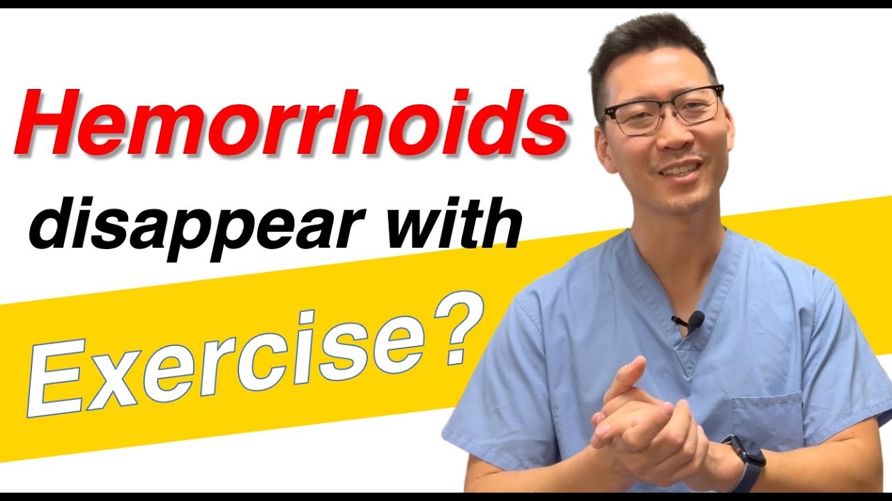 Can I keep hemorrhoids away with exercise? YouTube