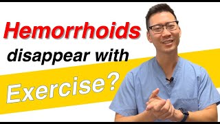 Can I keep hemorrhoids away with exercise?